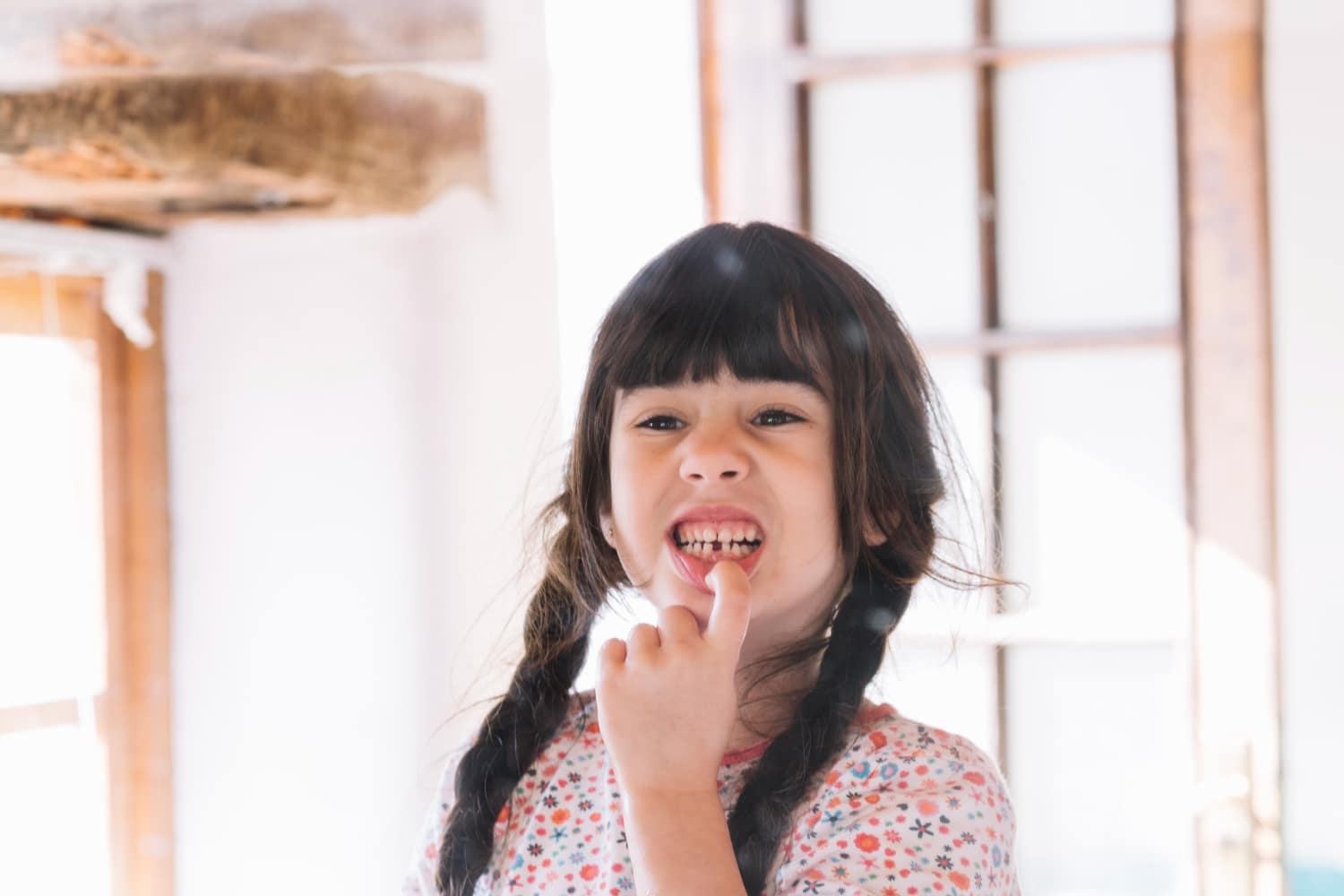 Most Childhood Tooth Injuries Are Preventable