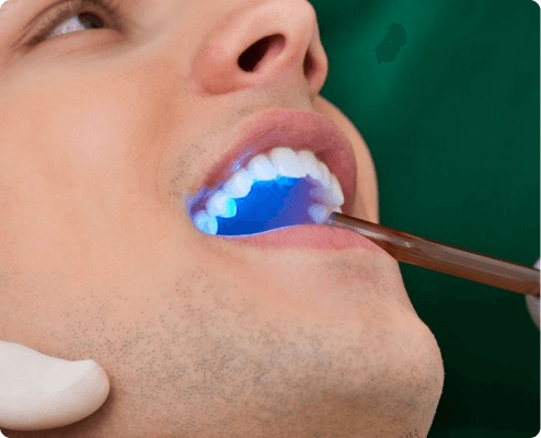 Oral Cancer Screening Explained