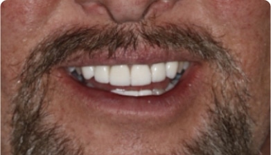 men Dental Image