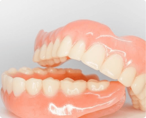 Traditional Full Dentures